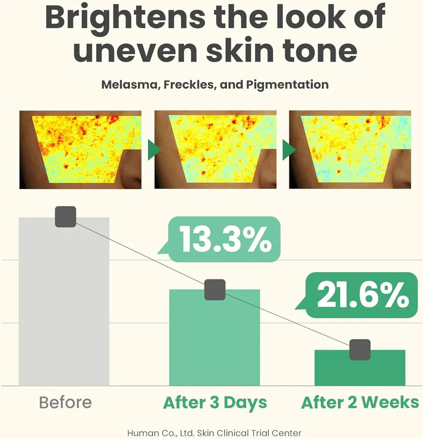 AXIS-Y Dark Spot Correcting Glow Serum – Brighten, Fade, Glow 50ml