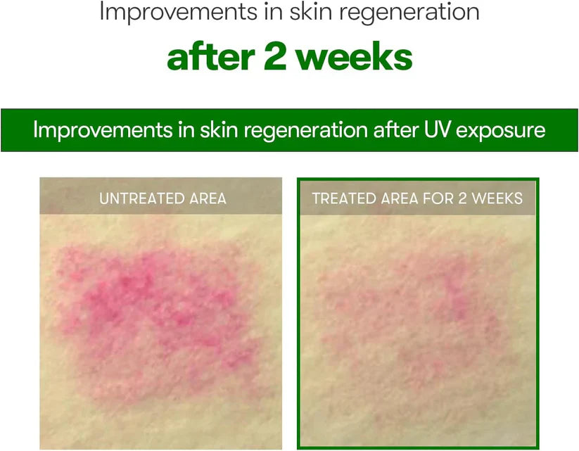 VT COSMETICS CICA Reedle Shot 100 / 300