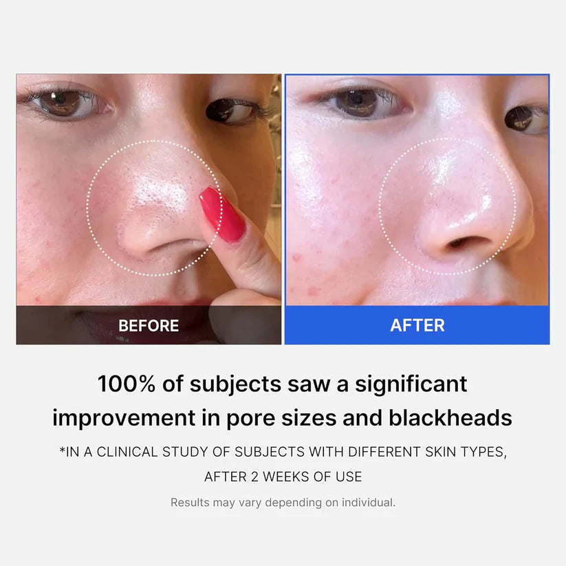 Medicube Zero Pore Pads 2.0 | 70 Pads