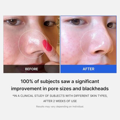 Medicube Zero Pore Pads 2.0 | 70 Pads