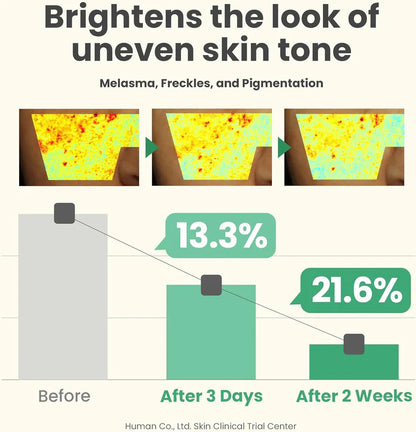 AXIS-Y Dark Spot Correcting Glow Serum – Brighten, Fade, Glow 50ml