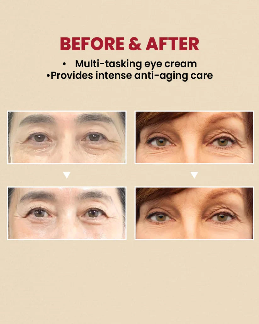 K SECRET SEOUL 1988 Eye Cream : Retinal Liposome 4% + Fermented Bean